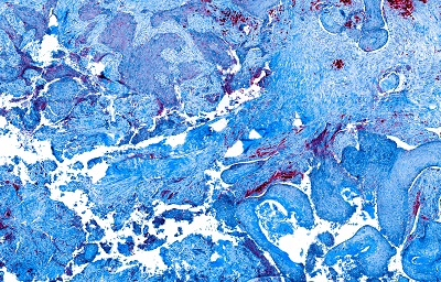 Western Blot內(nèi)參抗體如何選擇？